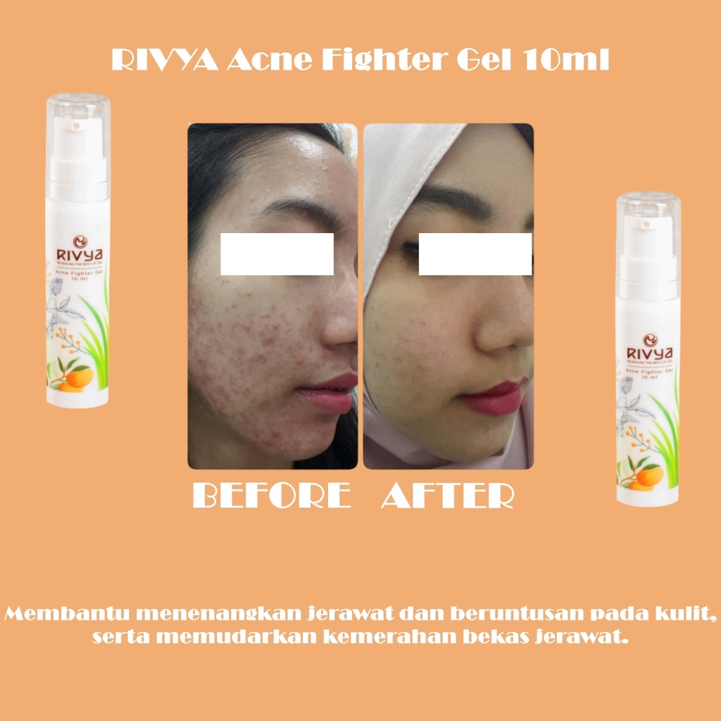 RIVYA Acne Fighter Gel 10ml BPOM - Apple_Kosmetik