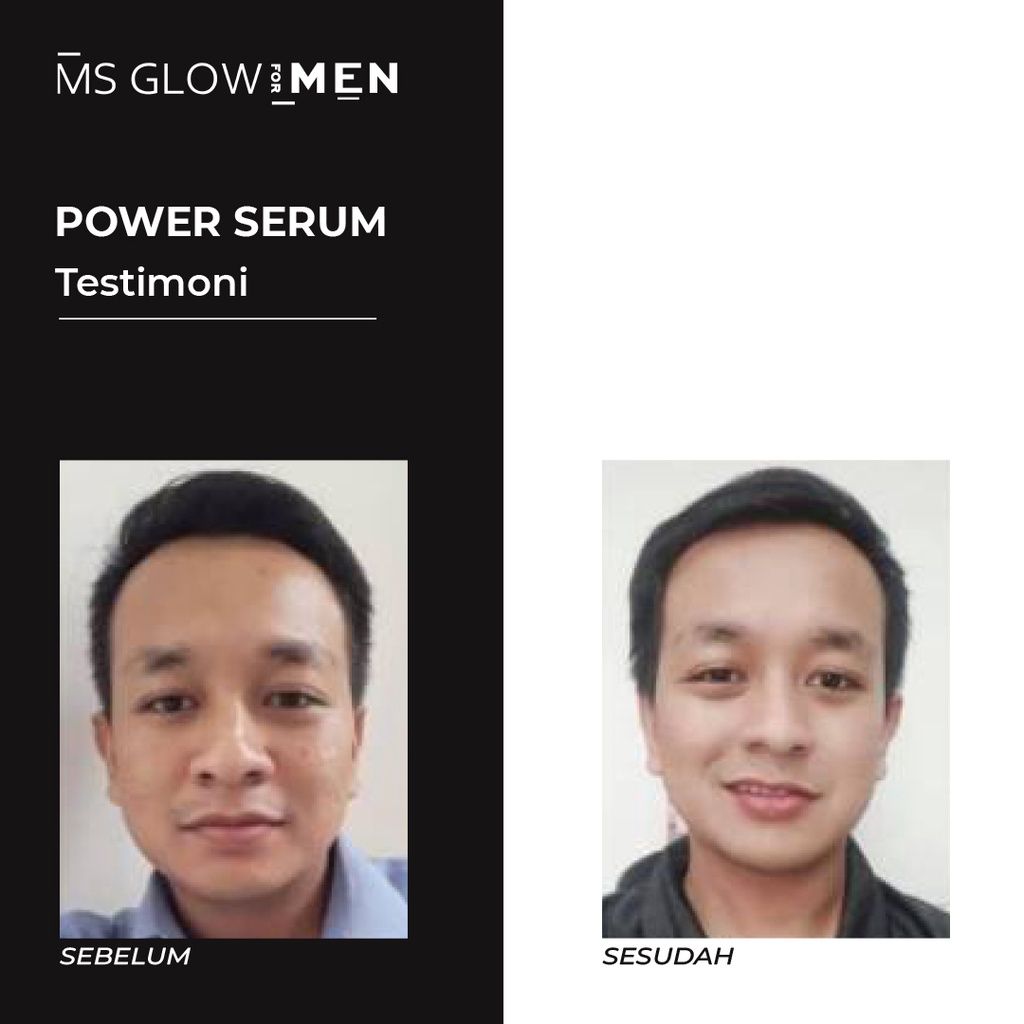 MS Glow For Men Skincare Cowok Original Power Serum by ms.glowofficialbandung