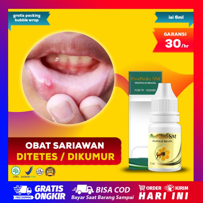 Obat Sariawan Panas Dalam Peradangan Mulut diTetes / Kumur Bibir Perih