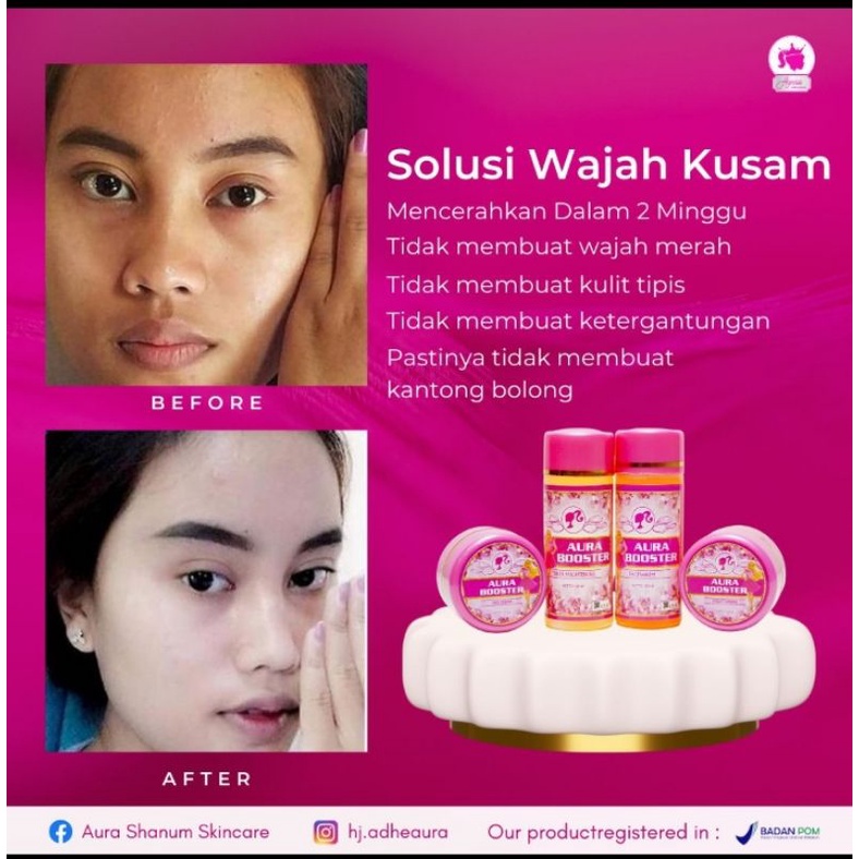 PAKET BOOSTER AURA SKINCARE (bisa COD)
