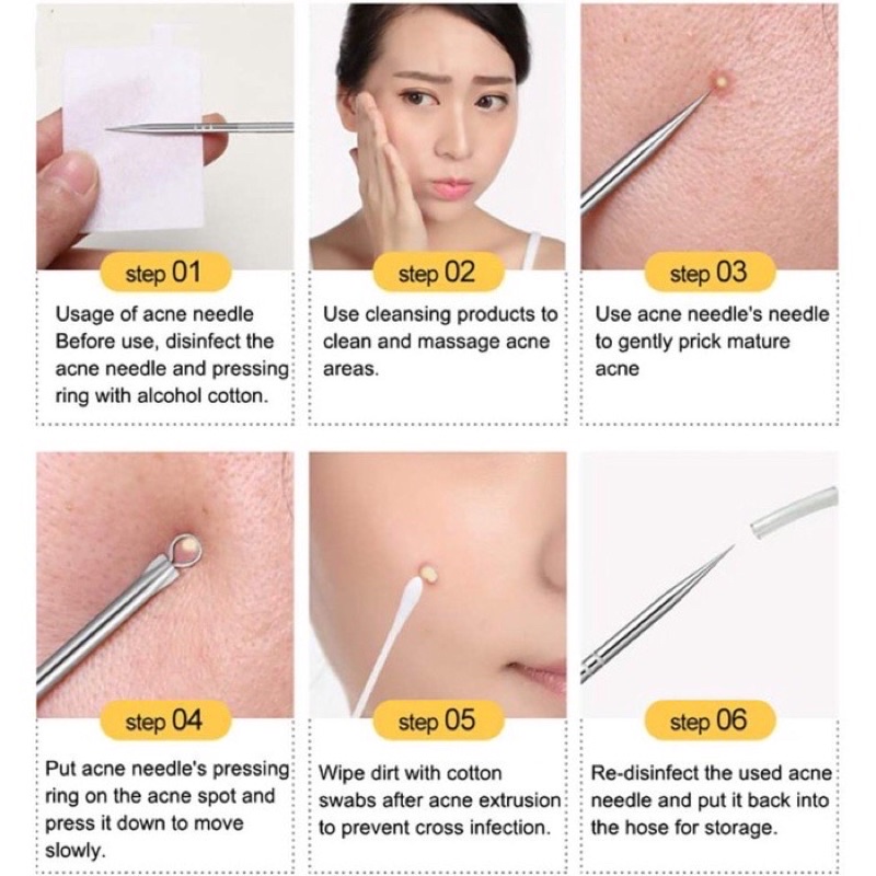 Alat Facial Pencet Komedo Pembersih Jerawat Blackhead Set 4 In 1 Free Box