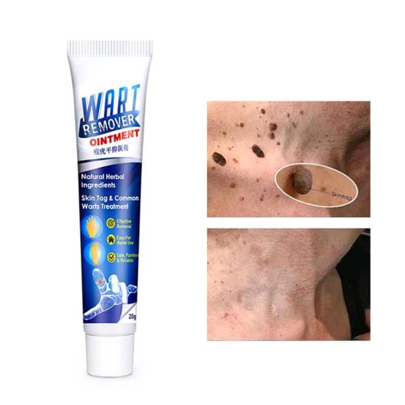 SUMIFUN Penghilang tahi lalat EELHOE wart remover ointment berkualitas