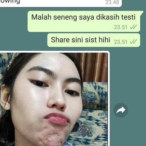 Terbaru스 SERUM AISH KOREA  AISH SERUM ORIGINAL | SERUM AISH ORIGINAL | AISH SERUM KOREA BPOM / AISH 