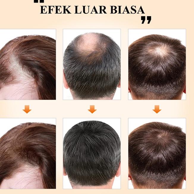 Special Price PURC HAIR GROWTH SERUM Pelembab rambut Minyak Esensial Jahe Perawatan perbaikan rambut