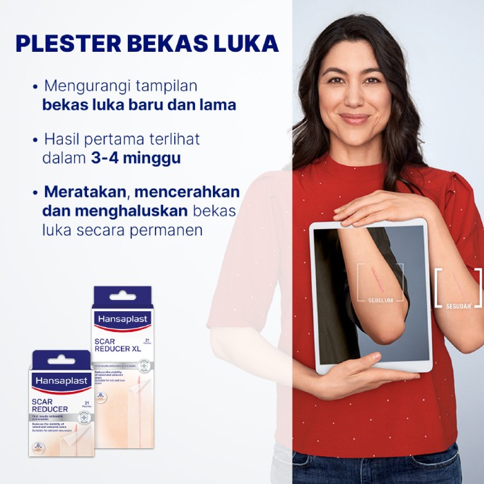 Hansaplast Plester Bekas Luka - Menghilangkan Bekas Luka & Keloid