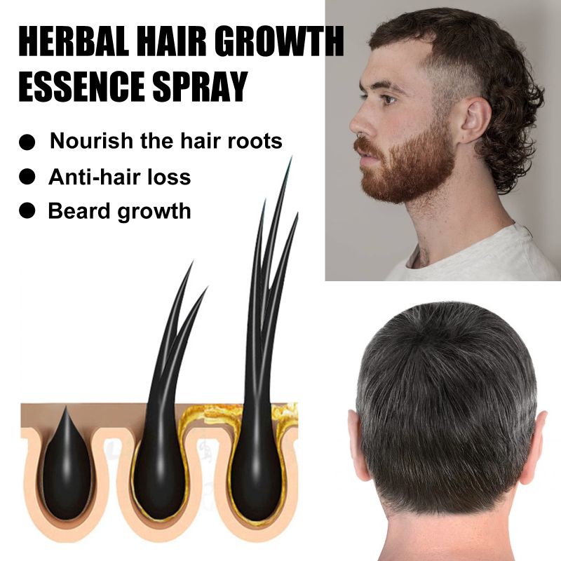 Eelhoe Herbal Hair Growth Essence Spray Penumbuh Rambut Rontok Botak anti hair loss aminexil Hair Tonic