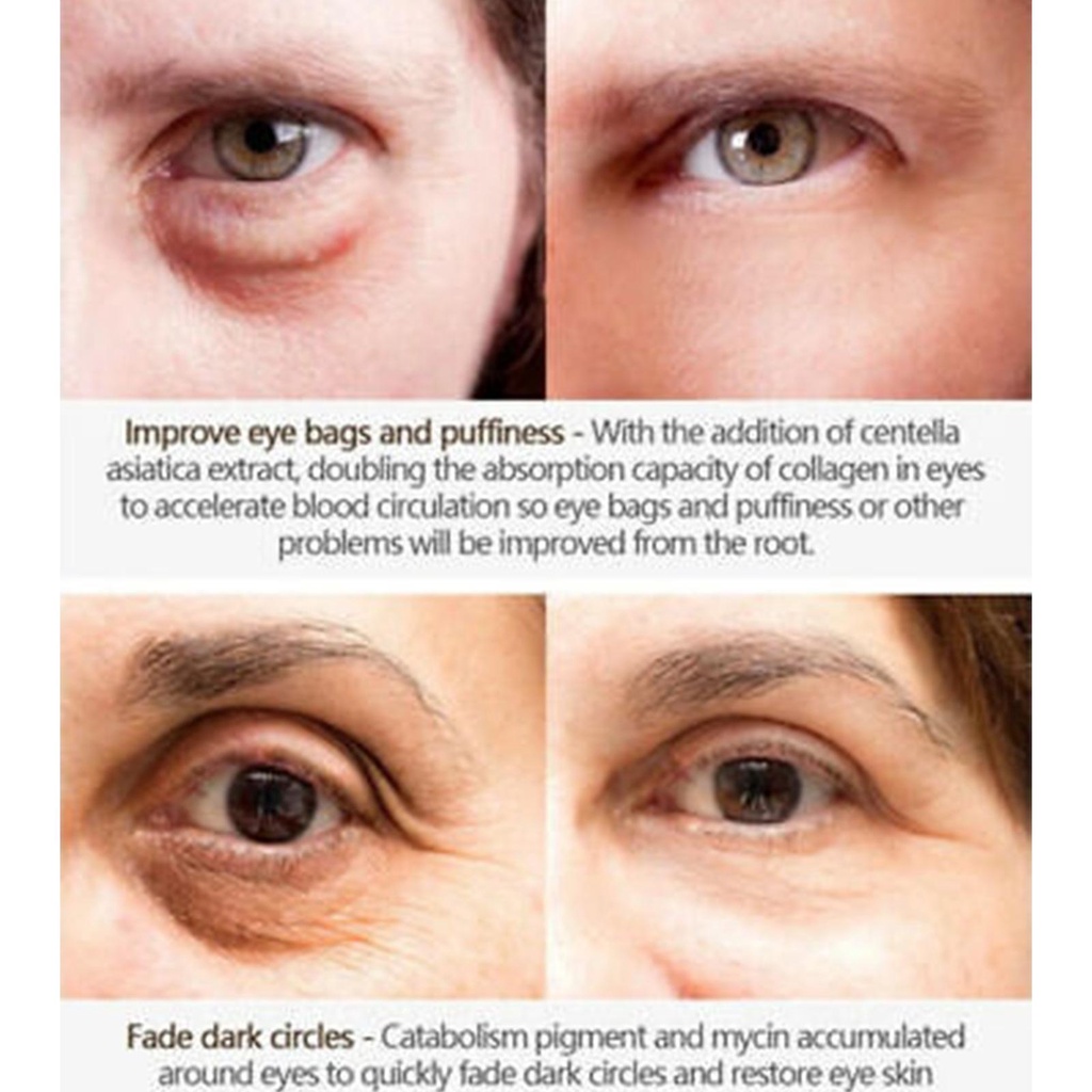 BISA COD / YAQINUO AVOCADO MOUSTURIZING EYE CREAM / KRIM PENGHILANG MILIA LEMAK BAWAH MATA/Krim Mata Penghidrasi Alpukat/