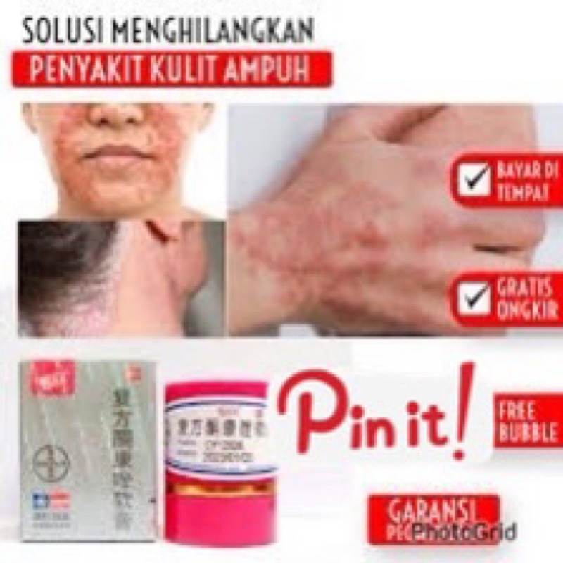 ORI 1000% ADA LOGO DIATAS GARANSI{Bisa kirim instant COD Medan Termurah}Salep Kulit Eksim KL BL PI KANG WANG Sangat bagus untuk gatal, kurap, kudis dll