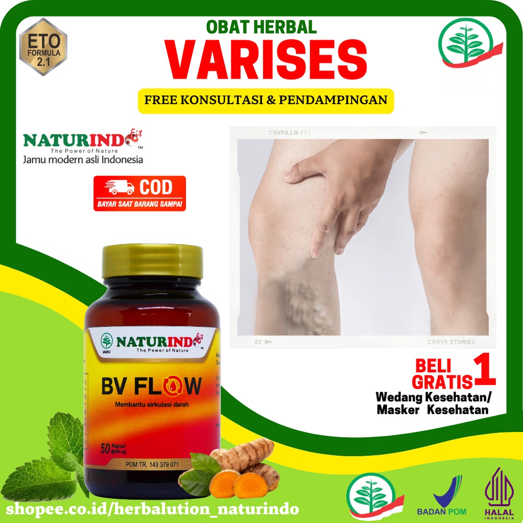 Obat Varises Di Kaki Dan Betis Paling Ampuh Obat Varikokel Bv Flow Obat Parises Kaki Paling Ampuh Ob