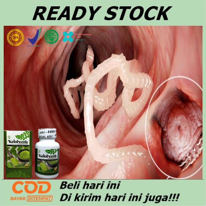 Obat Cacingan Untuk Dewasa & Anak Anak, Obat Cacing Usus, Cacing Kremi