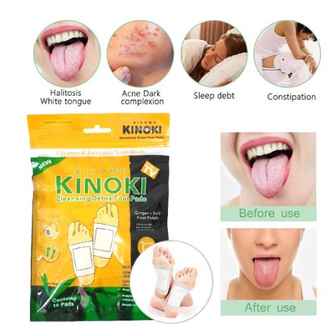 [Paket 10 Pak] Kinoki Gold Koyo Kaki Packing PLASTIK Toksin Racun Tubuh  Seal Kiyome Cleansing Detox Foot Pads