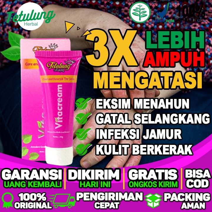 Cream Gatal Untuk Perut Ibu Hamil Cream Untuk Selangkangan Gatal Dan Hitam Dan Eksim Menahun