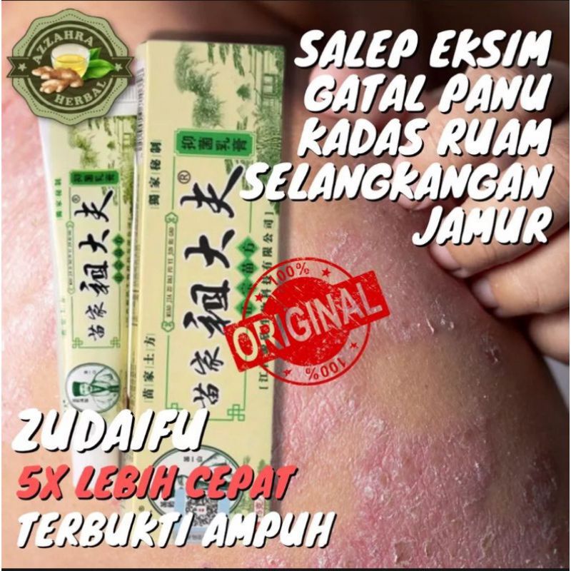 100% Asli ORIGINAL  Salep gatal Kurap Alergi Eksim Paling Ampuh