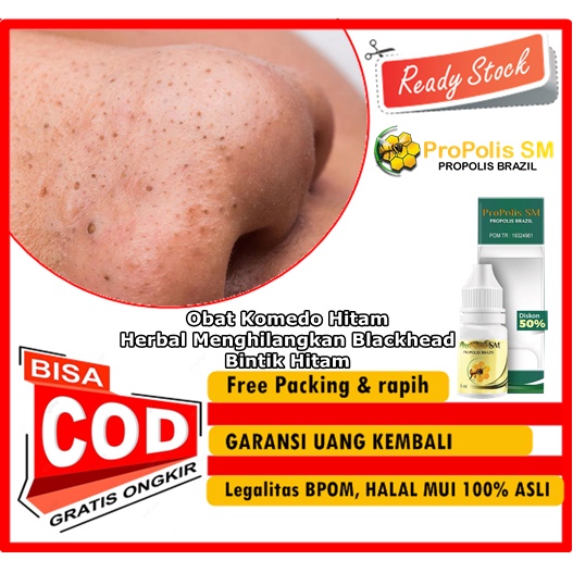 Obat Komedo Hitam - Herbal Menghilangkan Blackhead / Bintik Hitam - Komedo Membandel di hidung / Waj