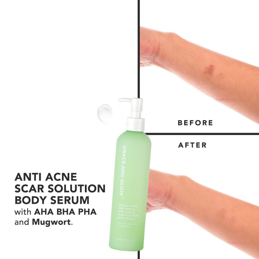 Serum Badan Penghilang Jerawat Punggung Grace and Glow English Pear and Freesia Anti Acne Body Serum 300 ml