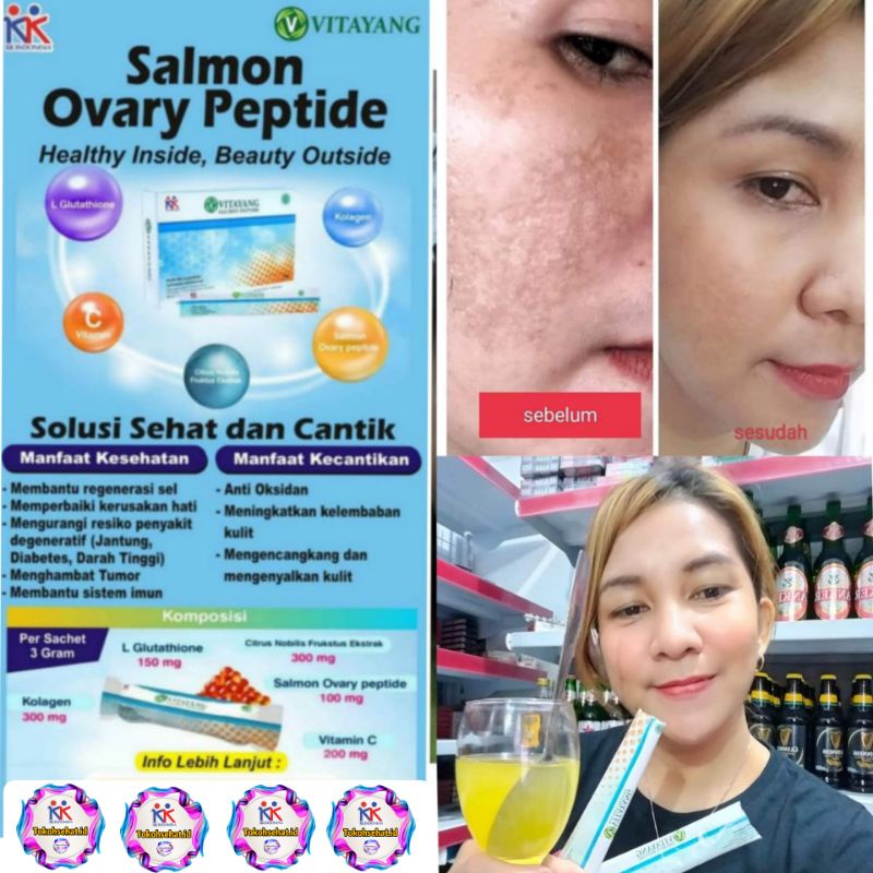 Vitayang SOP Salmon Ovary Peptide Minuman Kecantikan dari Jepan Menghilangkan Flek jerawat Mencerahkan wajah Suplemen Kesehatan Collagen Original KK Indonesia