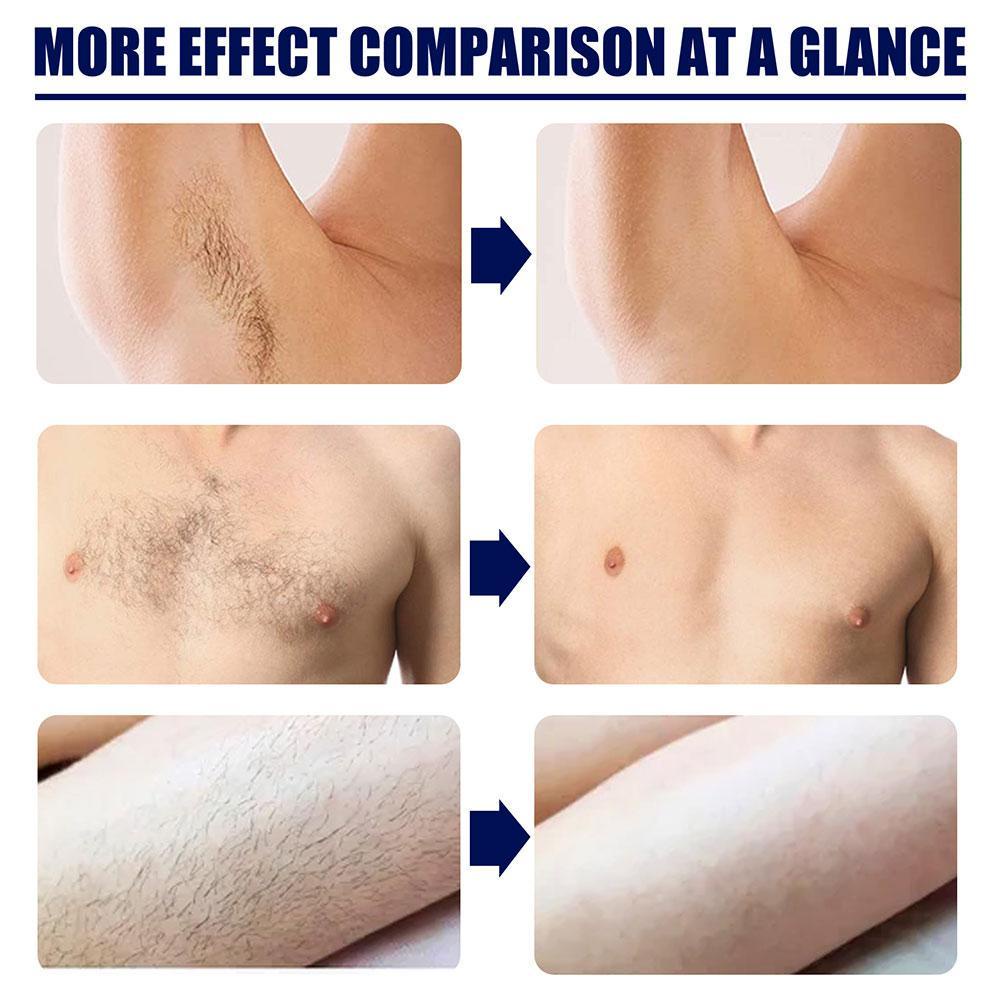 Krim Penghilang Bulu Pria Brewok Permanen Hair Removal Perontok bulu Kumis area wajah Cepat Tanpa Efek Samping