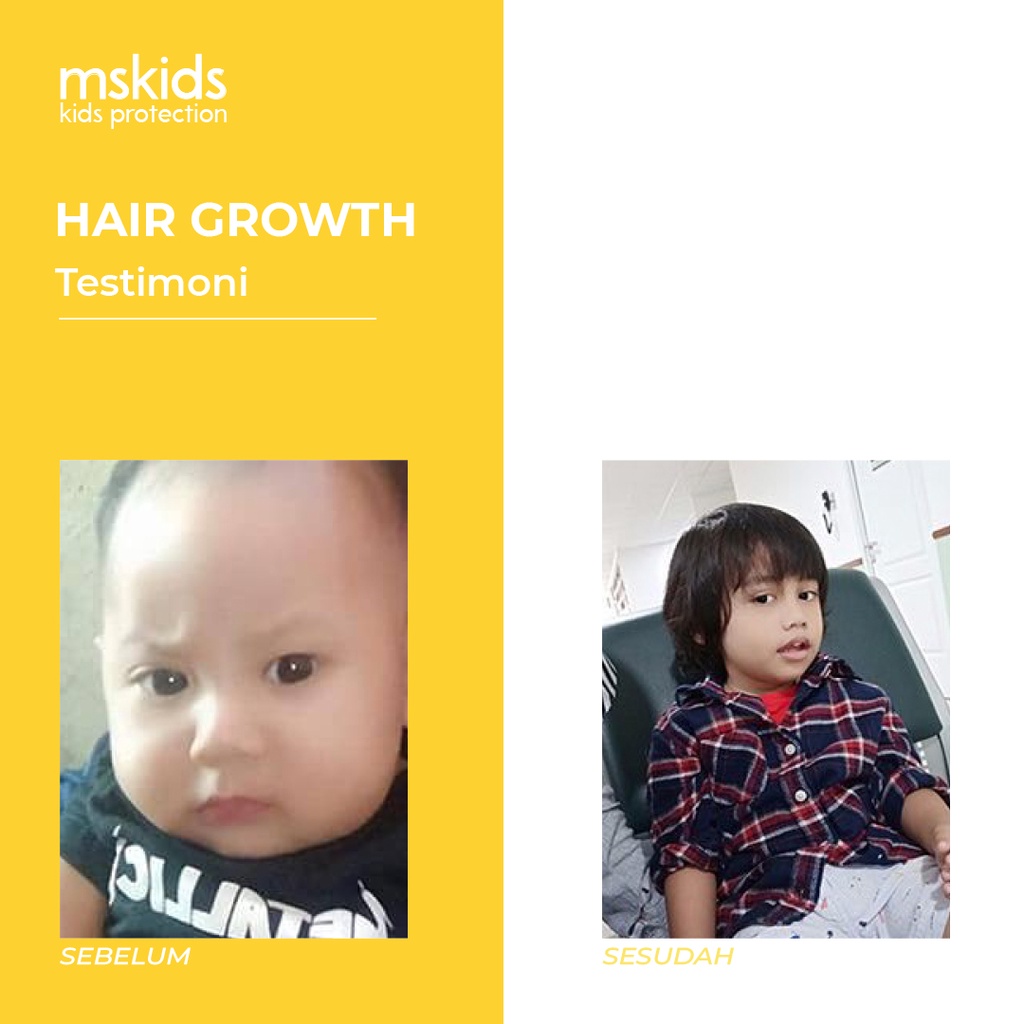 MS Glow Kids Original Hair Growth Shampoo MS Kids by ms.glowofficialbandung