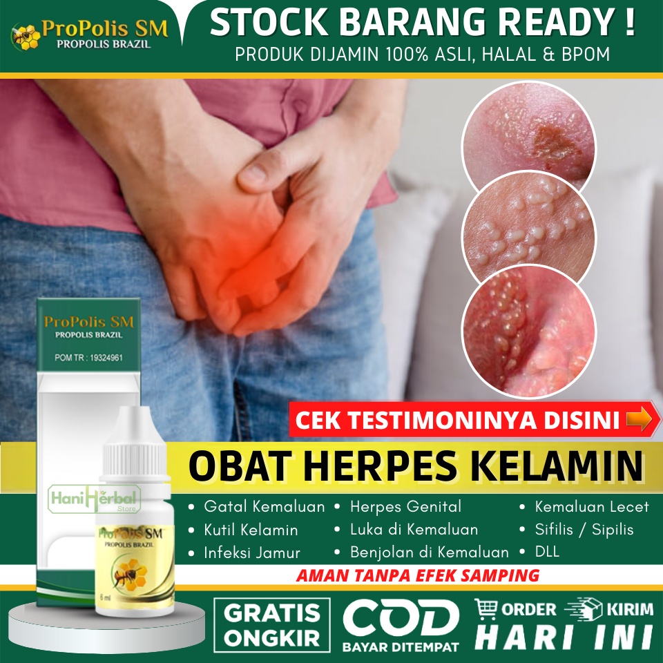 Obat Herpes Kelamin Alami 100% ASLI - Obat Herpes Genital, Obat Penghilang Bintik Berair di Kemaluan