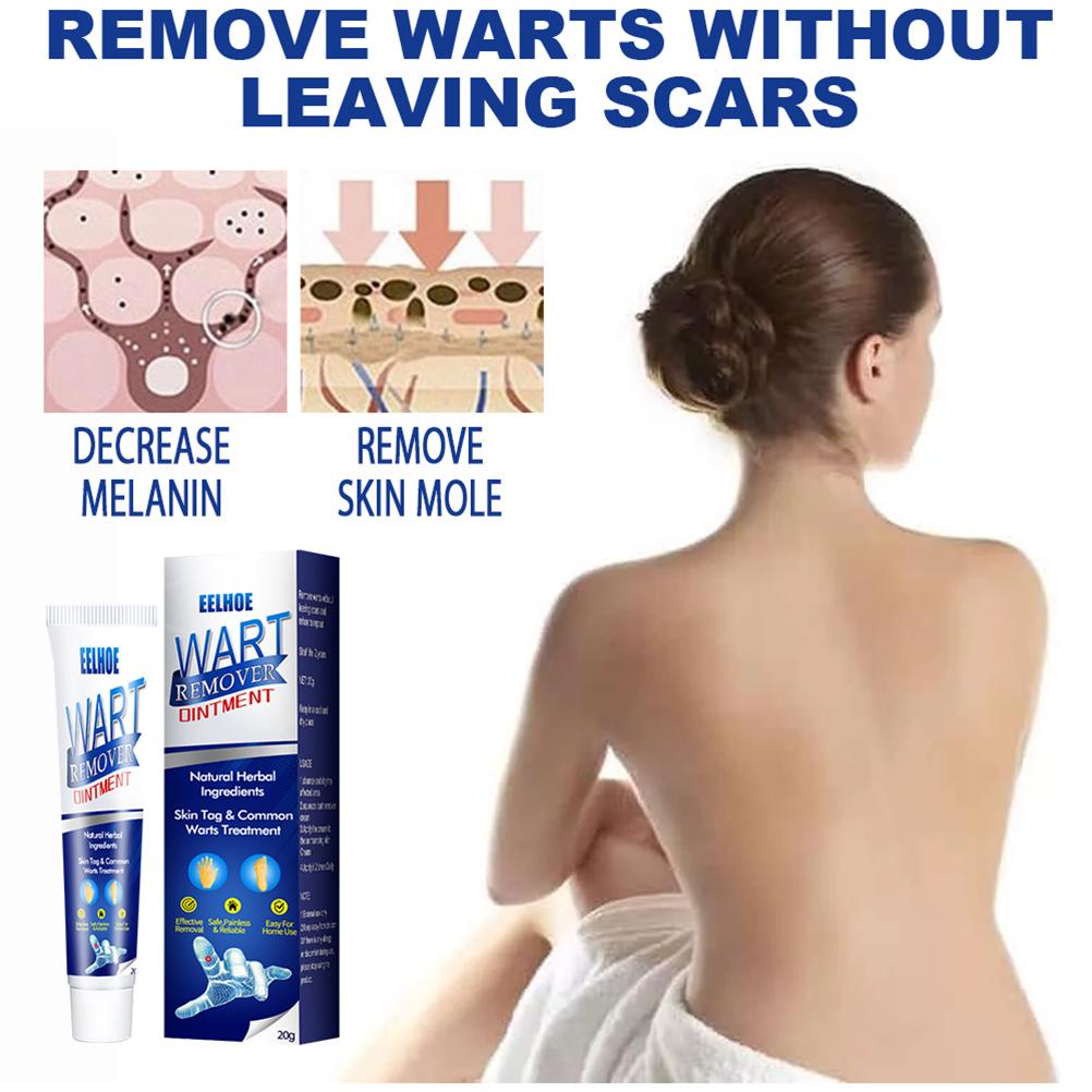 SHINE STAR - ORIGINAL Skin Tag Remover SUMIFUN EELHOE Wart Remover Ointment | Penghilang Tahilalat