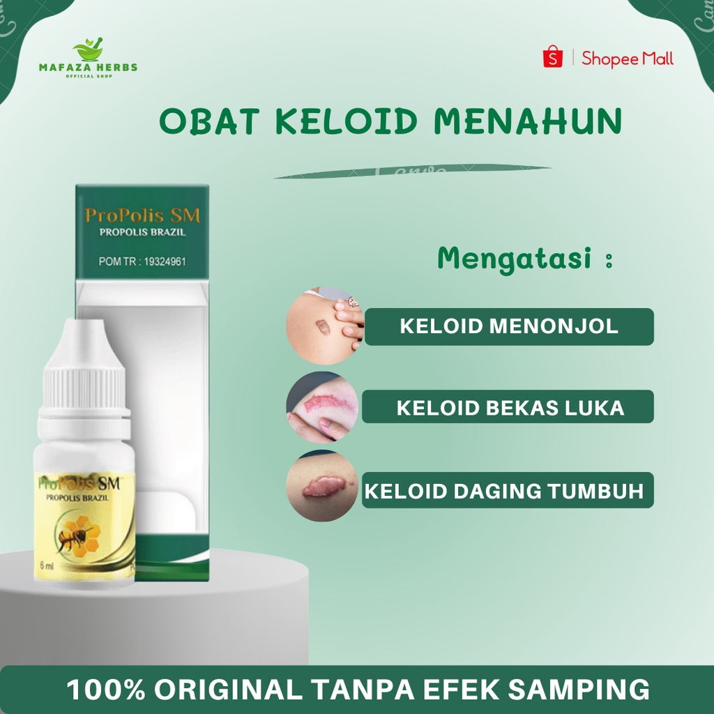 Jual Mafaza Herbs Obat Keloid Menonjol Tahunan, Bekas Luka Menonjol