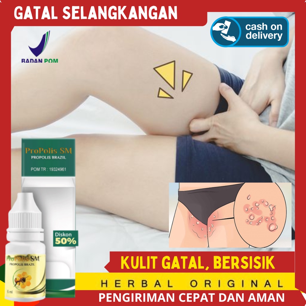 Salep oles Gatal Selangkangan - Salep Gatal Kulit Jamur  Obat Salep Gatal Kulit - Salep Gatal Jamur 