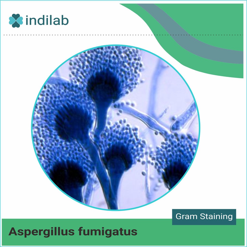 KUltur isolat jamur Aspergillus fumigatus