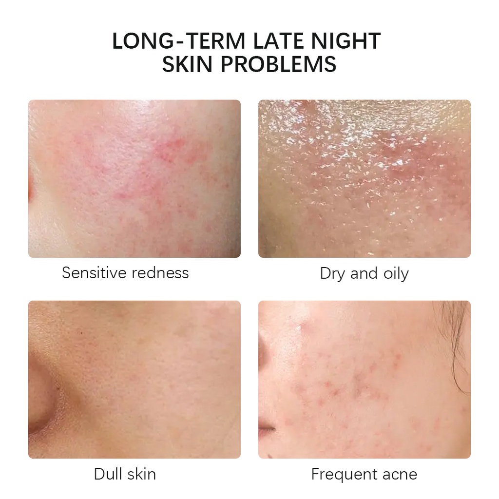 [Ori100%] Allphv Sheetmask Serum Mask Acne Treatment Vitamin C pemutih Pelembab Mengecilkan Poripori