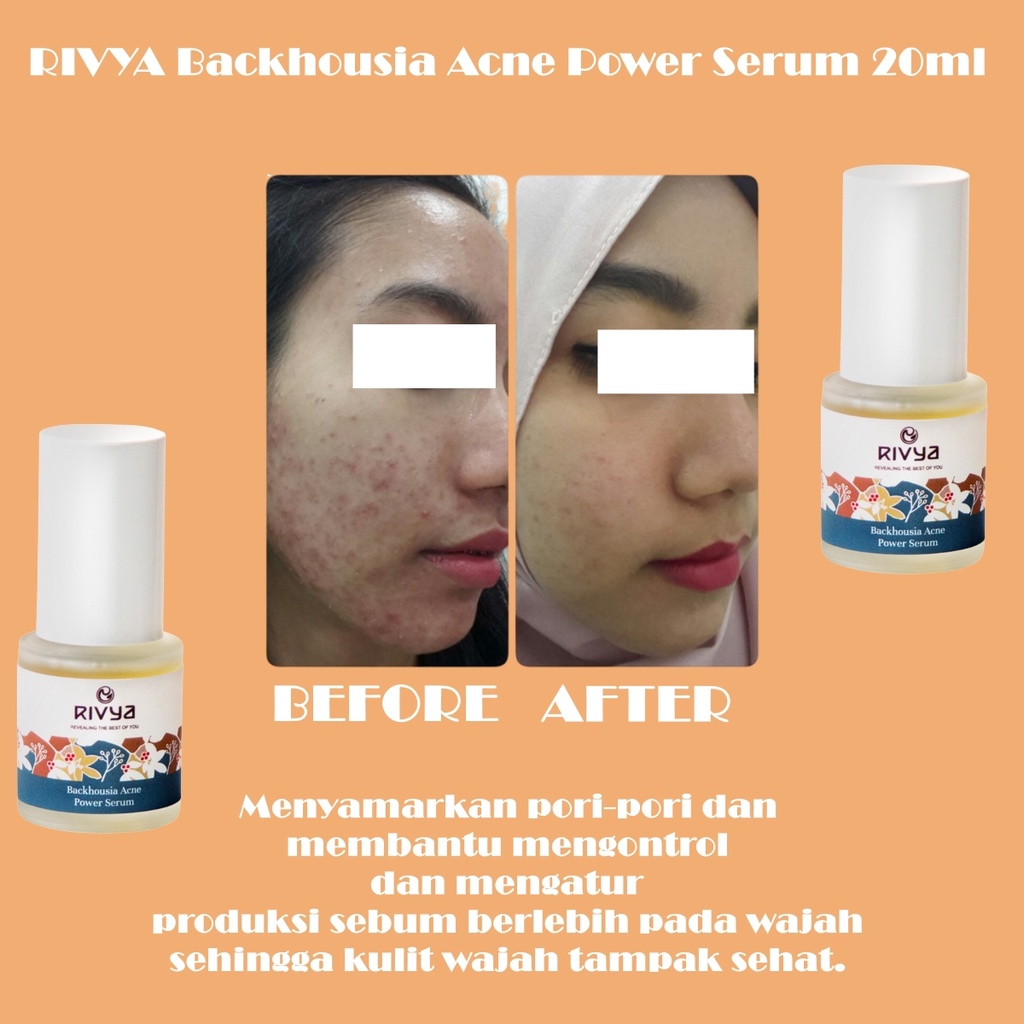 RIVYA Backhousia Acne Power Serum 20ml - Apple_Kosmetik