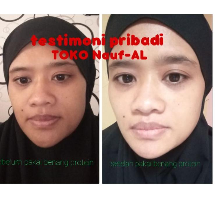 [V-16 ✓] [ORIGINAL] MOXIE GIRLZ GOLD PROTEIN LINE PEPTIDE Tanam Benang Tanpa Jarum Serum kecantikan 