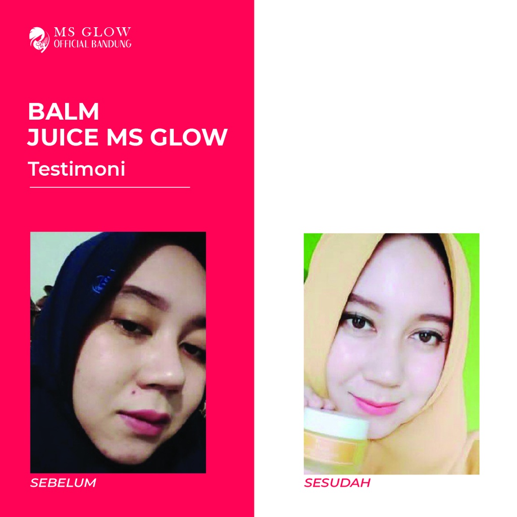 Balm Juice Ms Glow / Pembersih Make Up / Perawatan Wajah Termurah - By Msglowofficialbandung