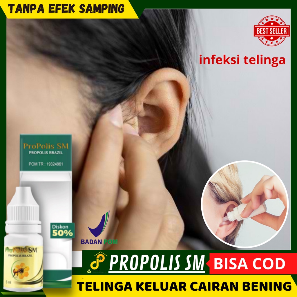 PSM obat tetes telinga obat telinga keluar cairan bening tidak berbau, telinga keluar cairan bening 