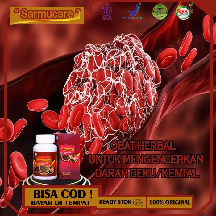 Jual Obat Herbal Pengencer Darah Beku Obat Pelancar Sirkulasi Darah Tersumbat Bekukental Obat 0294