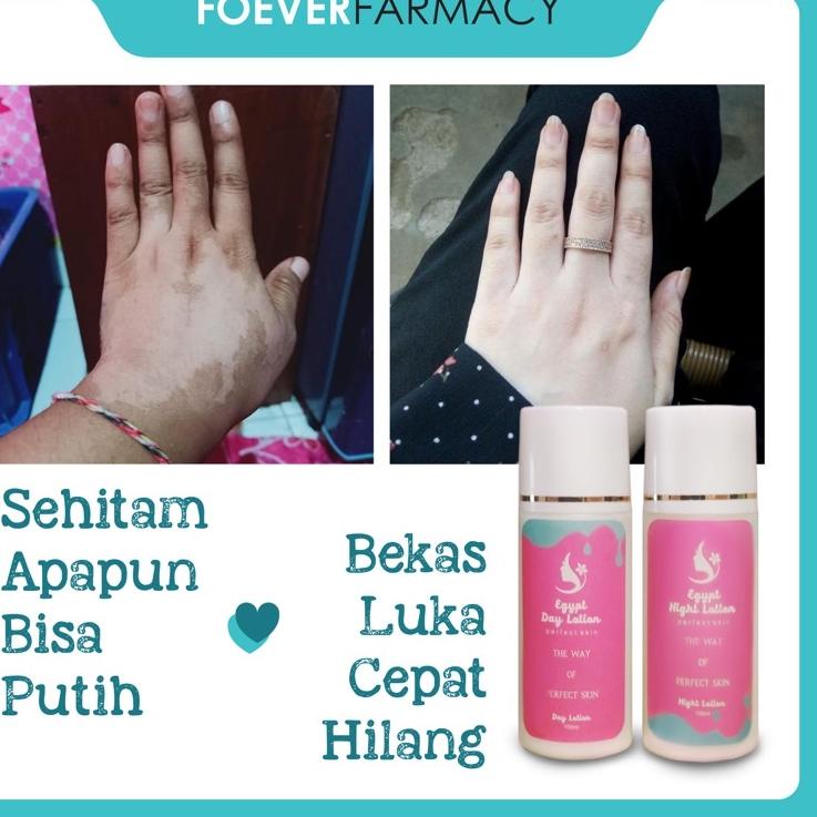 ✓ LOTION PEMUTIH PAGI & MALAM [ EGYPT WHITE ]