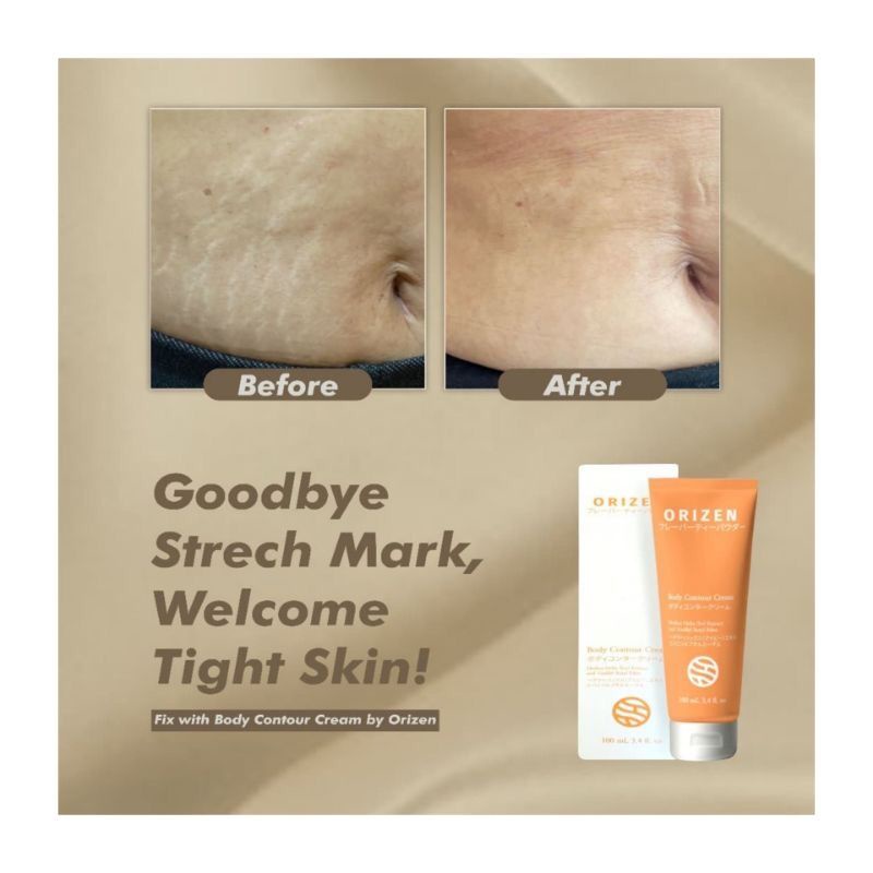 Orizen Body Contour Cream 100ml selulit