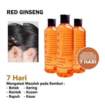 Red Ginseng Korea Hair Tonic 275ML/TONIC PENUMBUH RAMBUT BOTAK DAN PENYUBUR RAMBUT
