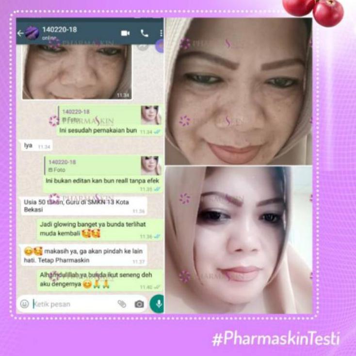 ✔ Paket Flek Lengkap Pharmaskin Solution 𝕺