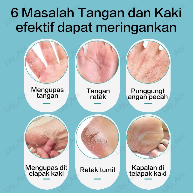 salep tangan dan kaki pecah / mengobati tumit kaki pecah , telapak tangan pecah , mengelupas, celah/ krim tangan , krim perbaikan / menghidrasi melembabkan, memperbaiki tumit kaki , telapak tangan