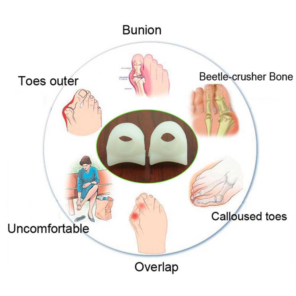 Sumifun Sleeve Korektor Tulang Jempol Hallux Valgus Orthotics - SM22 ( Mughnii )