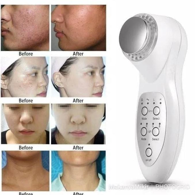 Alat Kecantikan Perawat Wajah Untuk Facial Detox