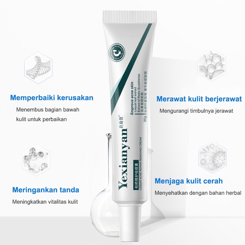 【ORANNLE】[100% Asli] Cream jerawat obat totol jerawat krim jerawat obat jerawat dan bekas jerawat Jerawat Removal of Acne Cream Untuk Pria dan Wanita