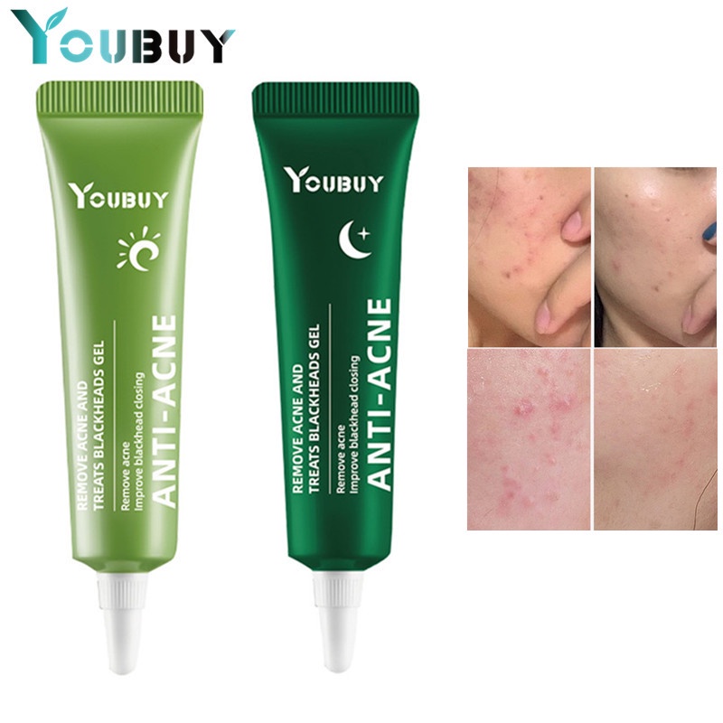 YOUBUY Acnes Sealing Gel 18G / Acne Gel / Gel Jerawat / Acne Care