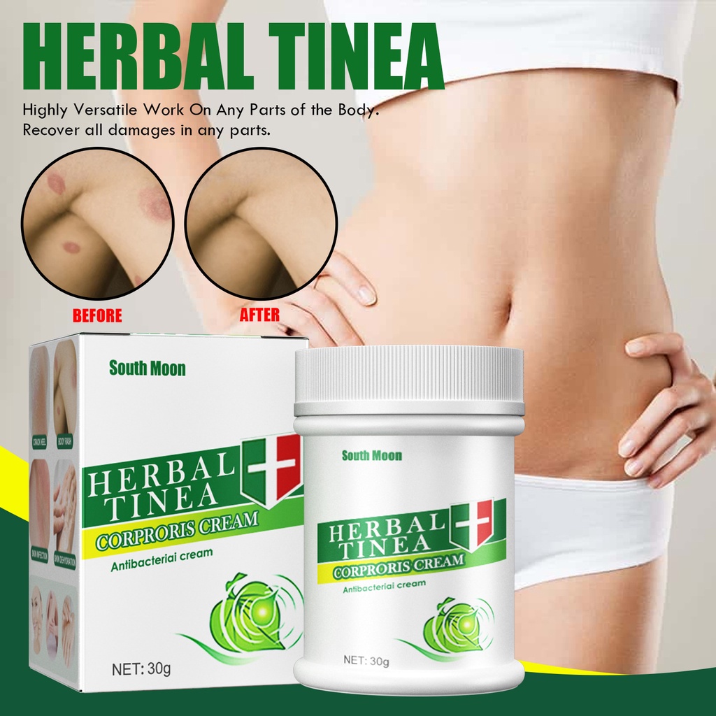 SALEP KULIT EKSIM AMPUH SALEP OBAT EKSIM Salep Asli 100% Original salep gatal/panu / eksim/jamur/kut