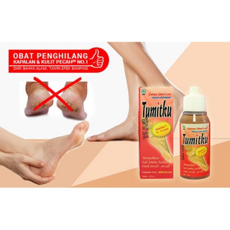 TUMITKU - ORIGINAL / Khusus untuk kaki kapalan.