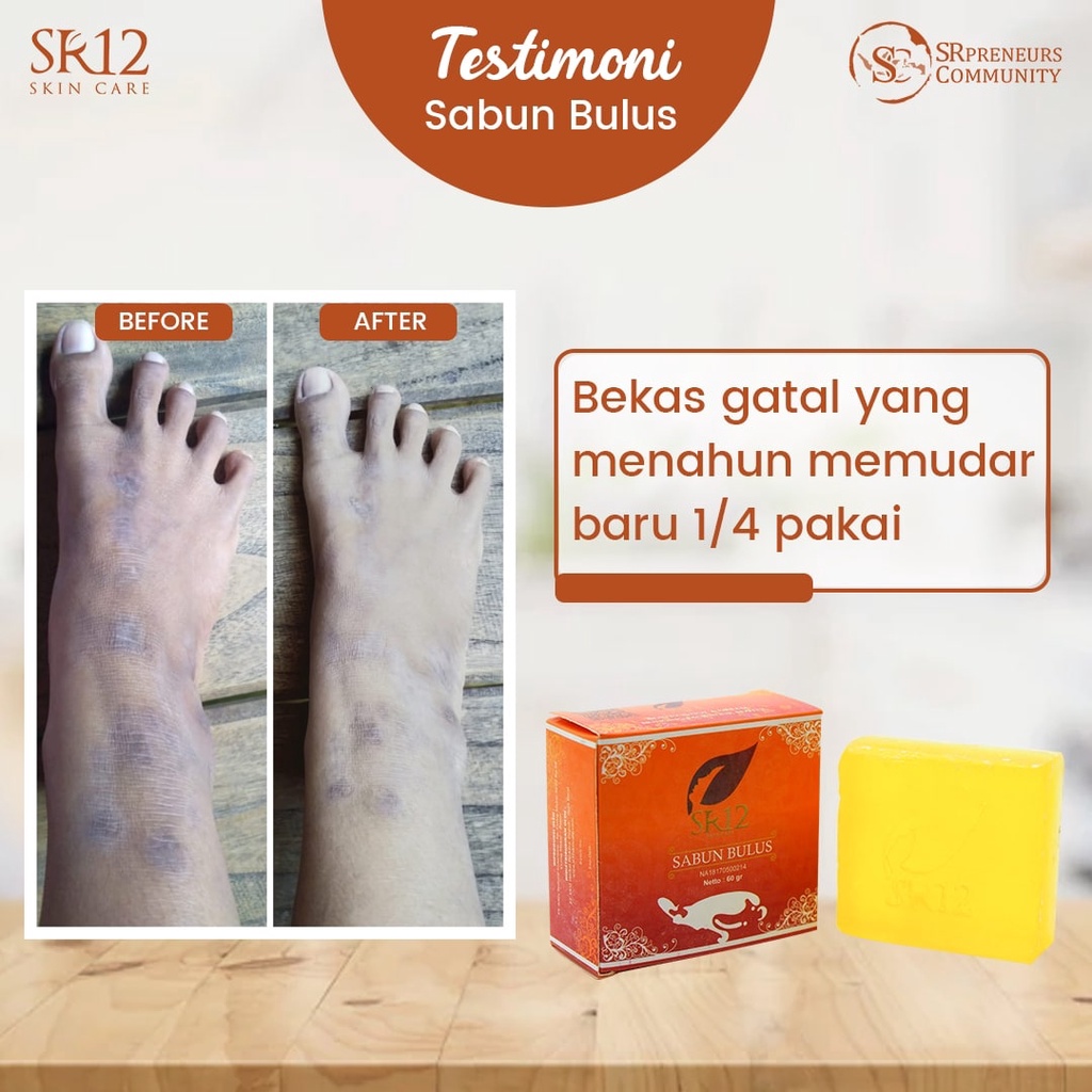SABUN BULUS SR12 HERBAL BPOM TERLARIS..!! SABUN WAJAH / BULUS SOAP  / SABUN GATAL / BULUS BAR SOAP ORIGINAL AMAN / SABUN MUKA SR12 HERBAL SKINCARE / SABUN HALAL / SABUN WAJAH BULUS ORIGINAL
