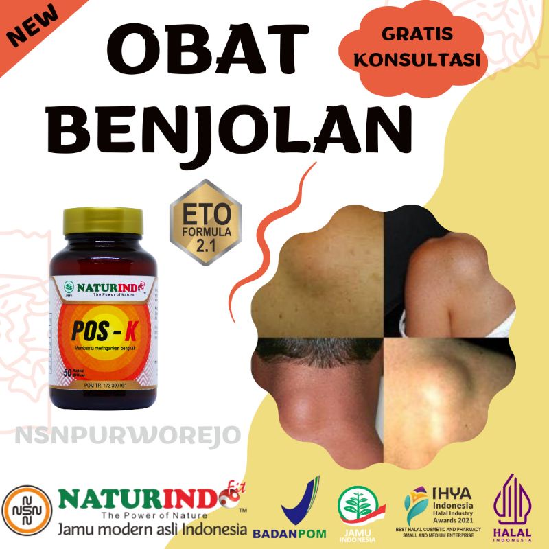 Obat Benjolan Payudara 50 Kapsul Lipoma Papiloma Gondok Bengkak Pembengkakan Kebentur Herbal Pos K N