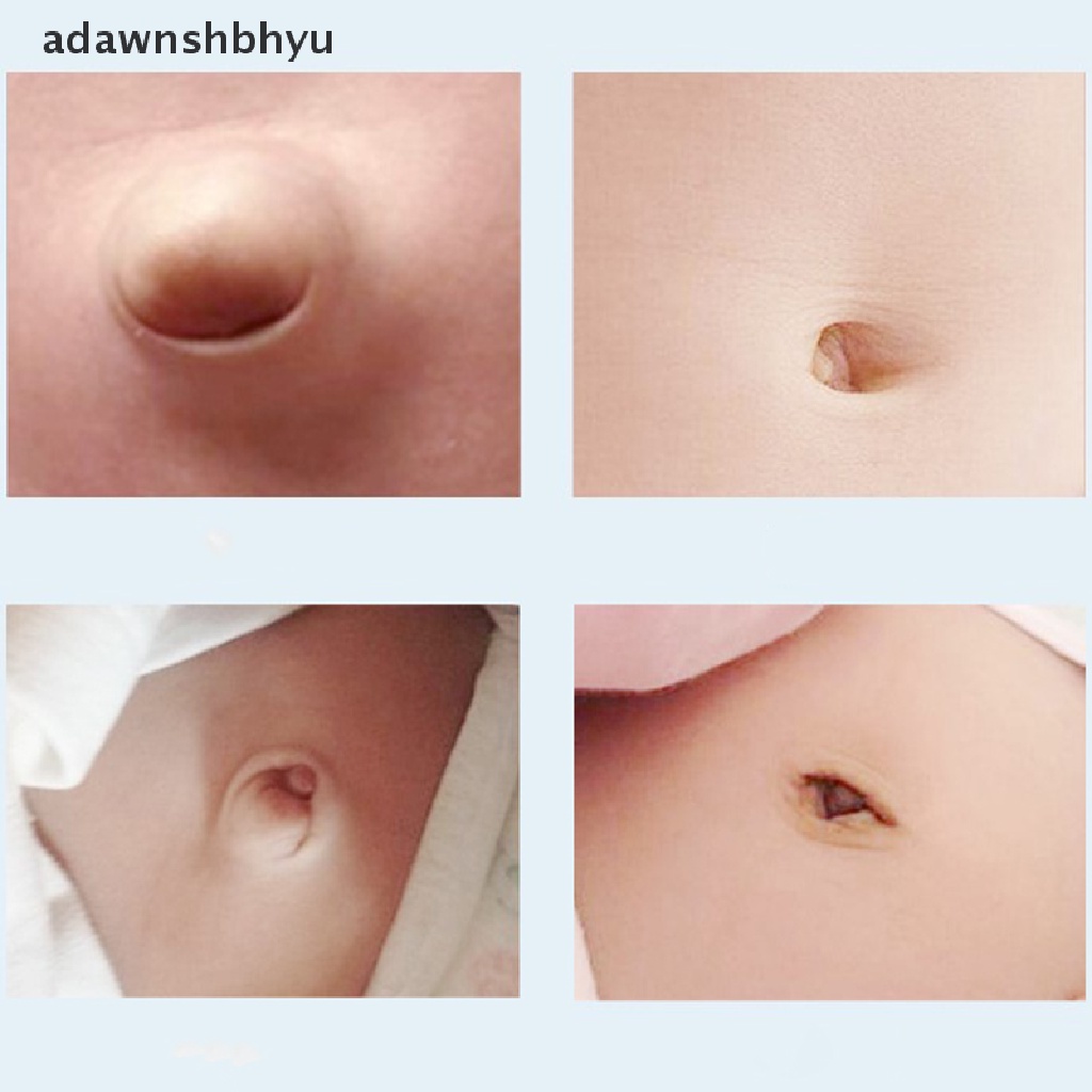 Adawnshbhyu 2pcs Sabuk Perawatan Terapi Hernia Umbilical Breathable Bag Tali Katun Elastis ID