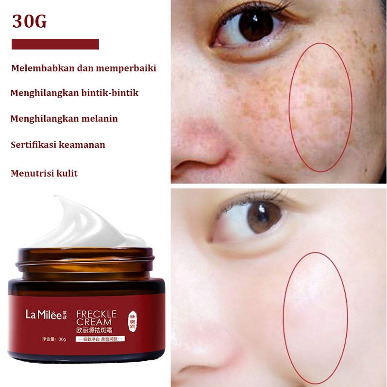 Krim bintik-bintik Krim penghilang bintik gelap Salep anti-bintik Meringankan melasma, bintik-bintik penuaan 30g Efektif menghilangkan flek hitam di wajah Krim pemutih wajah Cream whiteing Tidak melukai kulit