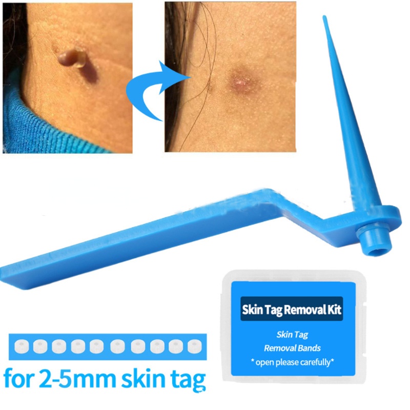 【31 PCS】Skin Tag Removal Tool/Wart Removal Tool/Alat Penghilang Kutil