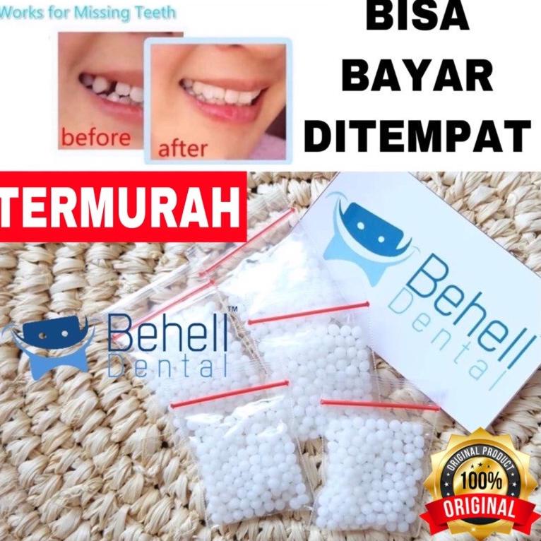 (I-2-T☛) GIGI PALSU SEMENTARA 200 BUTIR / PENAMBAL GIGI PATAH RENGGANG TEMPORARY TOOTH TEMPTOOTH GIN